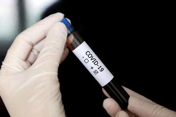 Test tube with covid-19 blood sample in hands close up. Doctor or scientist with positive coronavirus test