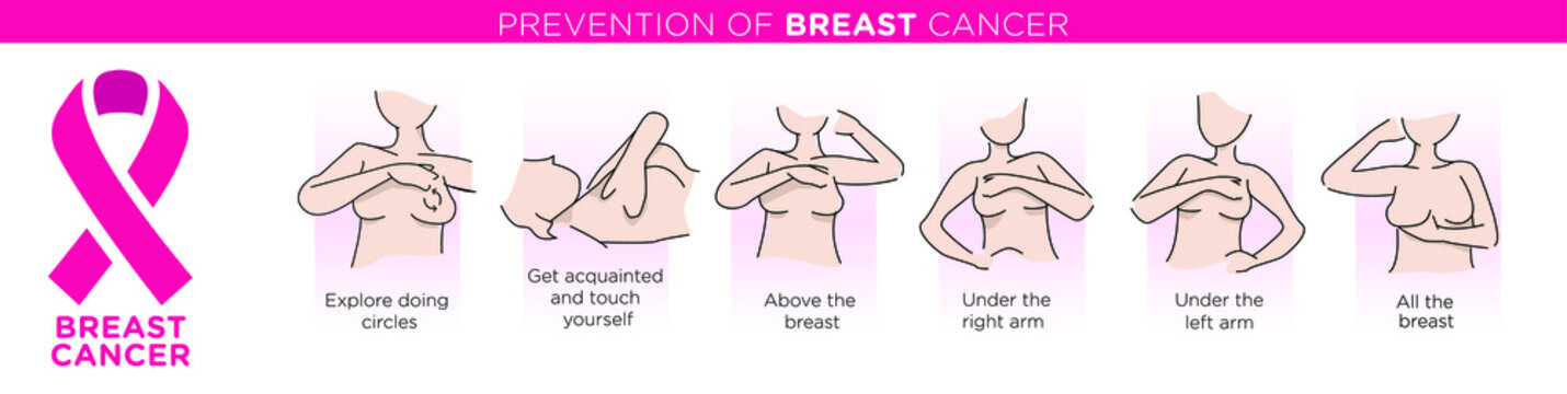 Prevenci&oacute;n del c&aacute;ncer de mama. Autoexamen. autoexploracion, Ilustraci&oacute;n vectorial. Cartel de atenci&oacute;n m&eacute;dica o plantilla de bander&iacute;n