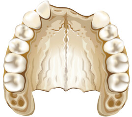 Maxillary bone atrophy with lost or damaged teeth - obrazy, fototapety, plakaty