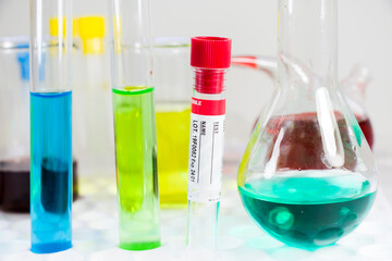 Blood test tube sample without name, empty space for text, laboratory background