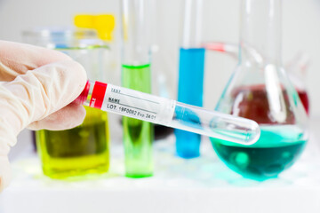 Blood test tube sample without name, empty space for text, laboratory background