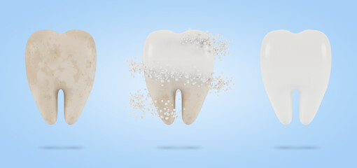 Tooth whitening. The concept of dental examination of teeth, dental health and hygiene. 3D illustration.