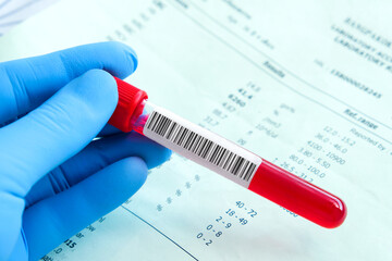 Complete blood samples and blood test results . Health and medical concepts