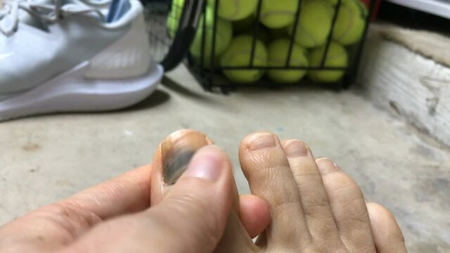 Woman massaging bruised big toe after a sports injury