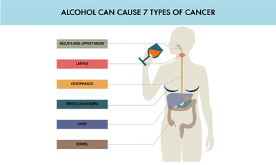 Alcohol causes cancer