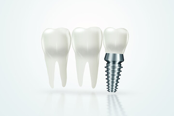 Dental implant, stainless post isolate on a white background, medical information poster. Teeth replacement concept, dentures, copy space. 3D illustration, 3D graphics.