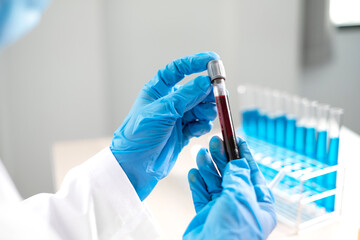 Professional doctors perform find virus tests from samples of blood tests to diagnose coronary...
