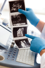 Lekarz ginekolog trzyma w ręku zdjęcie usg. Klinika ginekologiczna. 