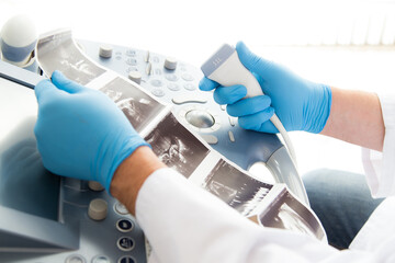 Fototapeta Lekarz ginekolog trzyma w ręku zdjęcie usg. Klinika ginekologiczna.  obraz