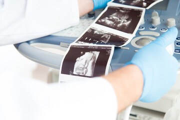 Lekarz ginekolog trzyma w ręku zdjęcie usg. Klinika ginekologiczna. 