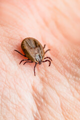 Encephalitis Infected Tick Insect Crawling on Skin. Lyme Borreliosis Disease or Encephalitis Virus Infectious Dermacentor Tick Arachnid Parasite Macro.