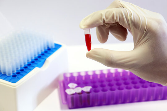 Micro Centrifuge tube with blood sample in solution handle in scientist hand wear surgical gloves, with tips micropipette and purple eppendorf racks, biotechnology analysis experiment for anti-virus.