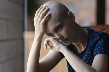 Upset sad young Caucasian woman with hairless bald head suffer from cancer feel depressed crying at...