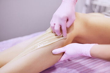 Epilation with liquate sugar at legs