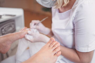 Obraz na płótnie Canvas Professional medical pedicure procedure close up using double nail instrument. Patient visiting chiropodist podiatrist. Foot treatment in SPA salon. Podiatry clinic. Pedicurist hands in white gloves.