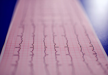 Cardiology Paper Graph on With Blurred Background
