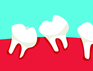Oral cavity with teeth that grow crooked.Flat vector illustration.