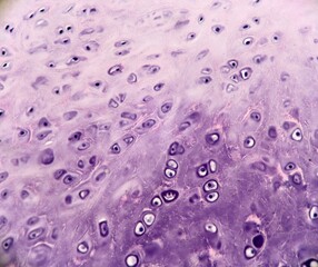 A section of elastic cartilage from an accessory tragus. Microscopic view.