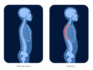 Spine X ray