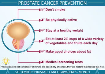 Prostate cancer prevention infographic vector. September prostate cancer awareness month concept. Well-organized Eps 10 file.
