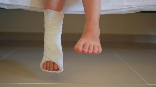 a little girl has a cast on her leg. Child's ankle rewound with a bandage