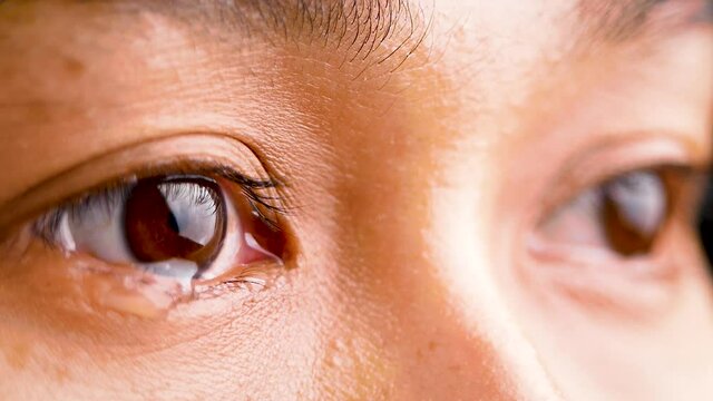 Close up of Asian woman crying with tear and little freckles on her beautiful face.