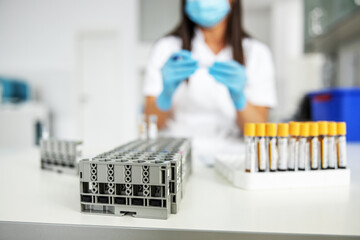 Test tubes with blood samples.