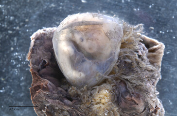 40 days old human embryo inside the amniotic sac, over a fragment of the placenta.