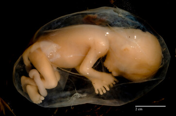 13,5 week old human fetus inside de amniotic sac (without the rest of the placenta).