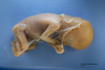 13,5 week old human fetus partially covered by the amniotic membrane.