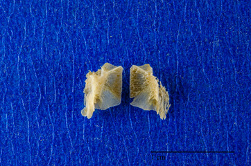 Lower surface of palatine bones, palate development, 10 weeks old human fetus.