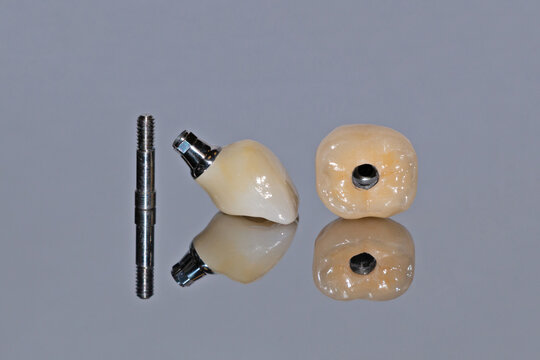 Incisor and molar crowns for implant fixation. Screw fixation of the tooth prosthesis, screw. Close-up on a gray background with reflection.