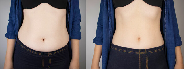 The girl shows the results of work on the body. Before and after a thick and thin waist. In the photo on the left, belly fat is visible. In the photo on the right, a thin waist without extra kilograms