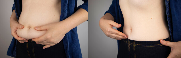 The girl shows the results of work on the body. Before and after a thick and thin waist. In the...