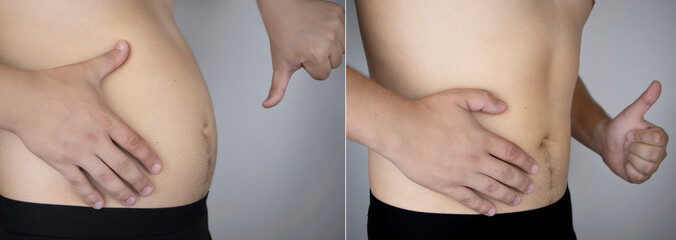 The man shows the results of work on the body. Before and after a thick and thin waist. In the...