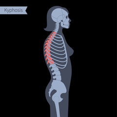 Spine X ray