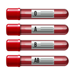 Set of Glassware tube filled blood with different characters human blood type.