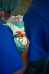 2 doctors perform a hematoma removal with sterile gloves on a lower leg