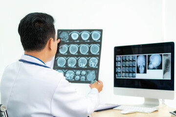 Fototapeta na wymiar Asian man doctor holding and looking to examining x-ray of the patient’s skull and brain in a medical clinic at hospital.