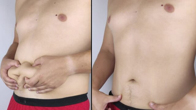 The man shows the results of work on the body. Before and after a thick and thin waist. In the photo on the left, belly fat is visible. In the photo on the right, a thin waist without extra kilograms
