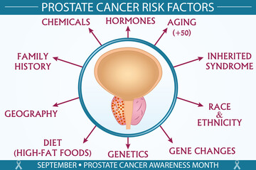 Prostate cancer risk factors infographic vector. September prostate cancer awareness month concept. Well-organized Eps 10 file.