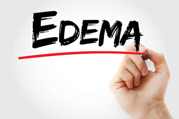 Edema text with marker, medical concept background