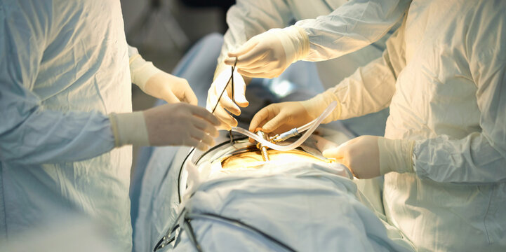 Surgeons performing a keyhole operation