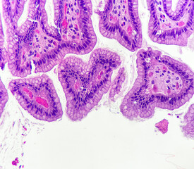 Photo of normal gastric mucosa. It looks like a heart with wings.