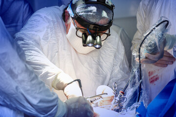 A surgical team operates on a patient in a hospital - obrazy, fototapety, plakaty