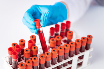 Doctor hand taking a blood sample tube from a rack in the lab