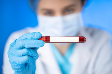 Technician holding blood tube test in the research laboratory
