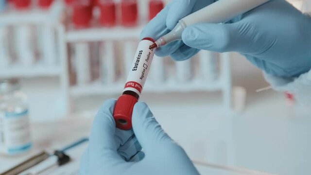 Doctor or laboratory technician holds in one hand laboratory positive blood test tube for the virus Ebola, other handwriting down results to patients medical record. Epidemic disease in Africa