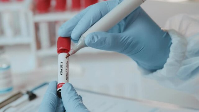 Doctor or laboratory technician holds in one hand laboratory blood sample tube for leukemia cells test, other handwriting down results to patients medical record. Laboratory medical diagnostics