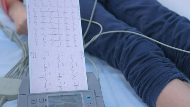 Doctor cardiologist making boy cardiogram heart procedure and printing result, legs closeup on background. Printout test's result on paper.